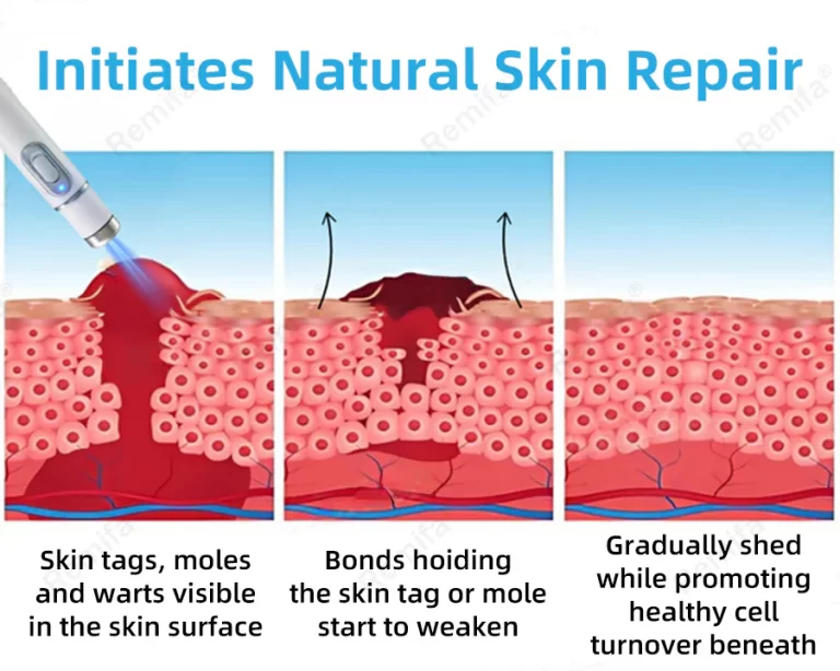 slide7