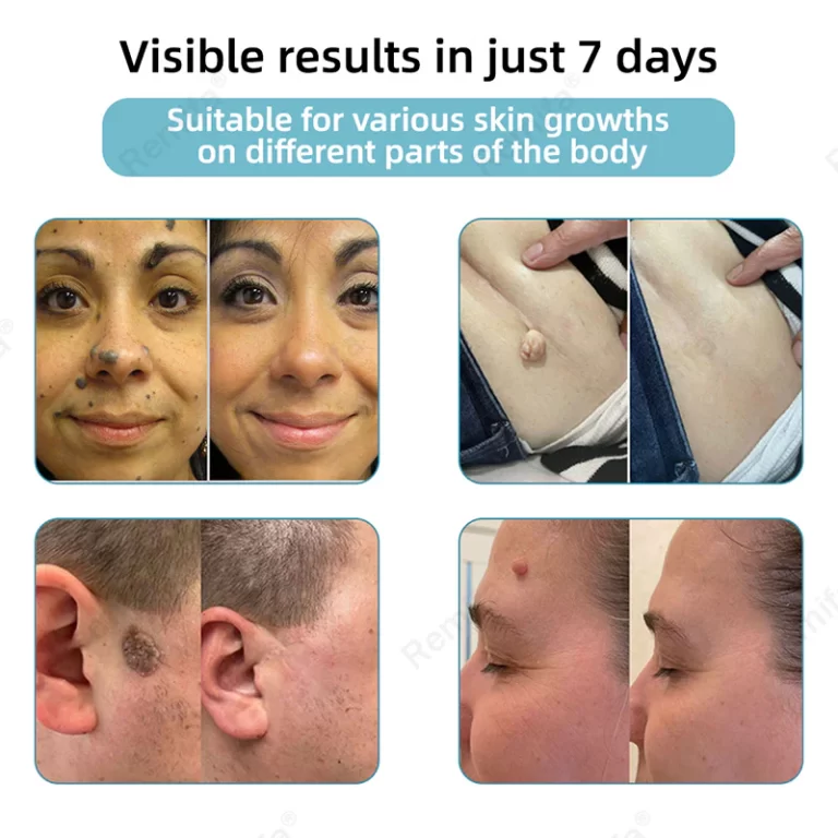 slide8